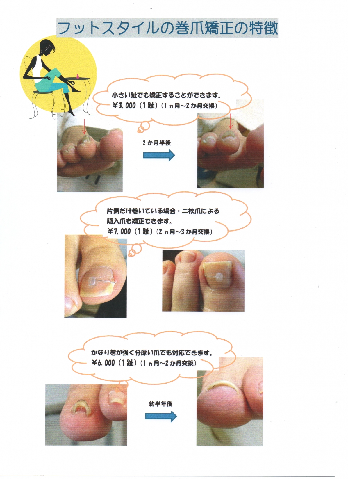 フットスタイル・フスフレーゲスクール【フスフレーゲとは、ドイツからきた足を健康に保つための療法です】_2